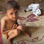 250528c-Gaza children Starvation300x200