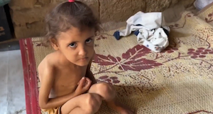 starving gaza children